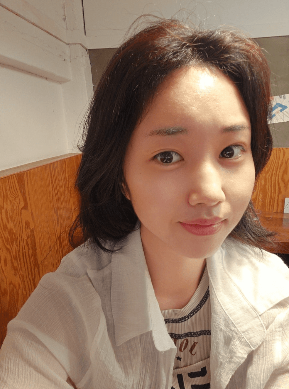 시술 후 변화 대박입니다!!