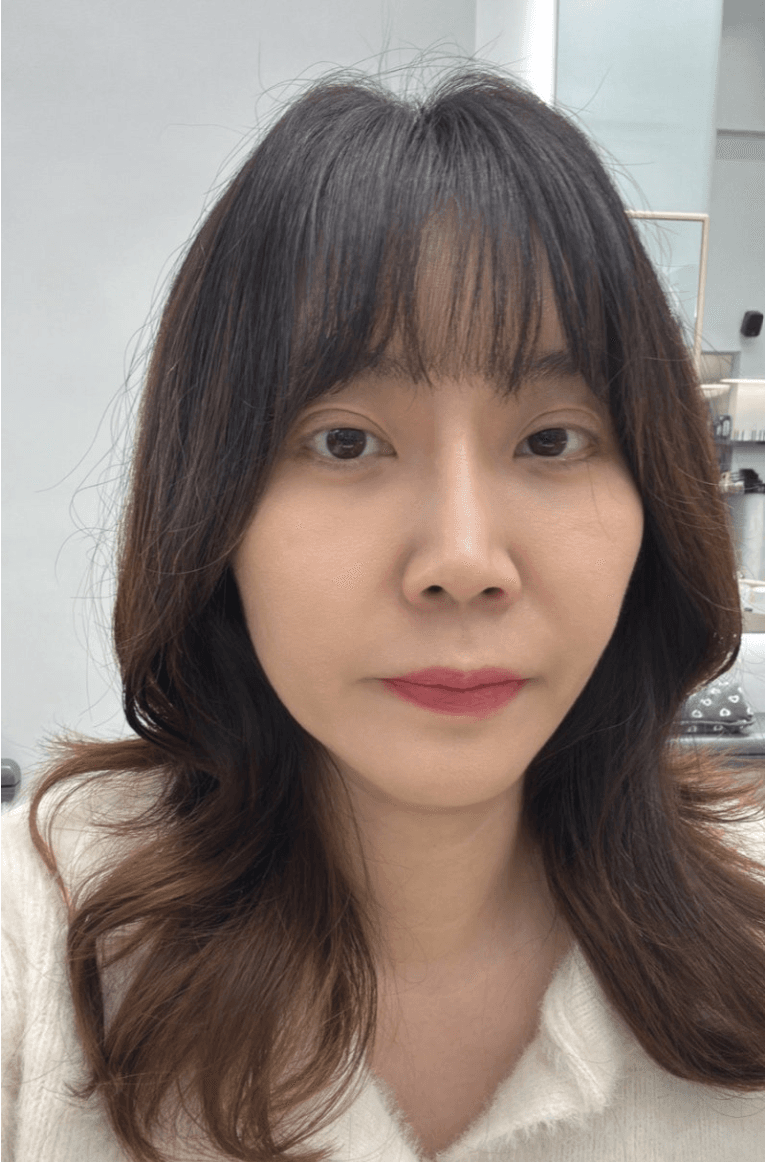 플래티넘의원에서 받은 튠페이스