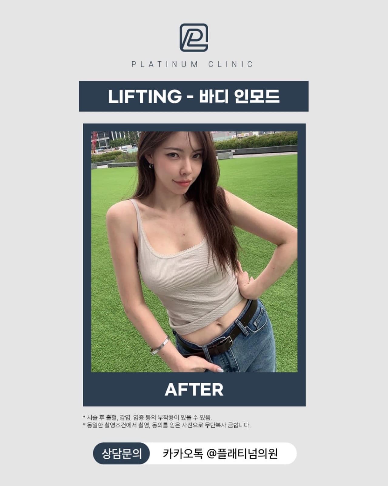 바디 인모드FX 결과