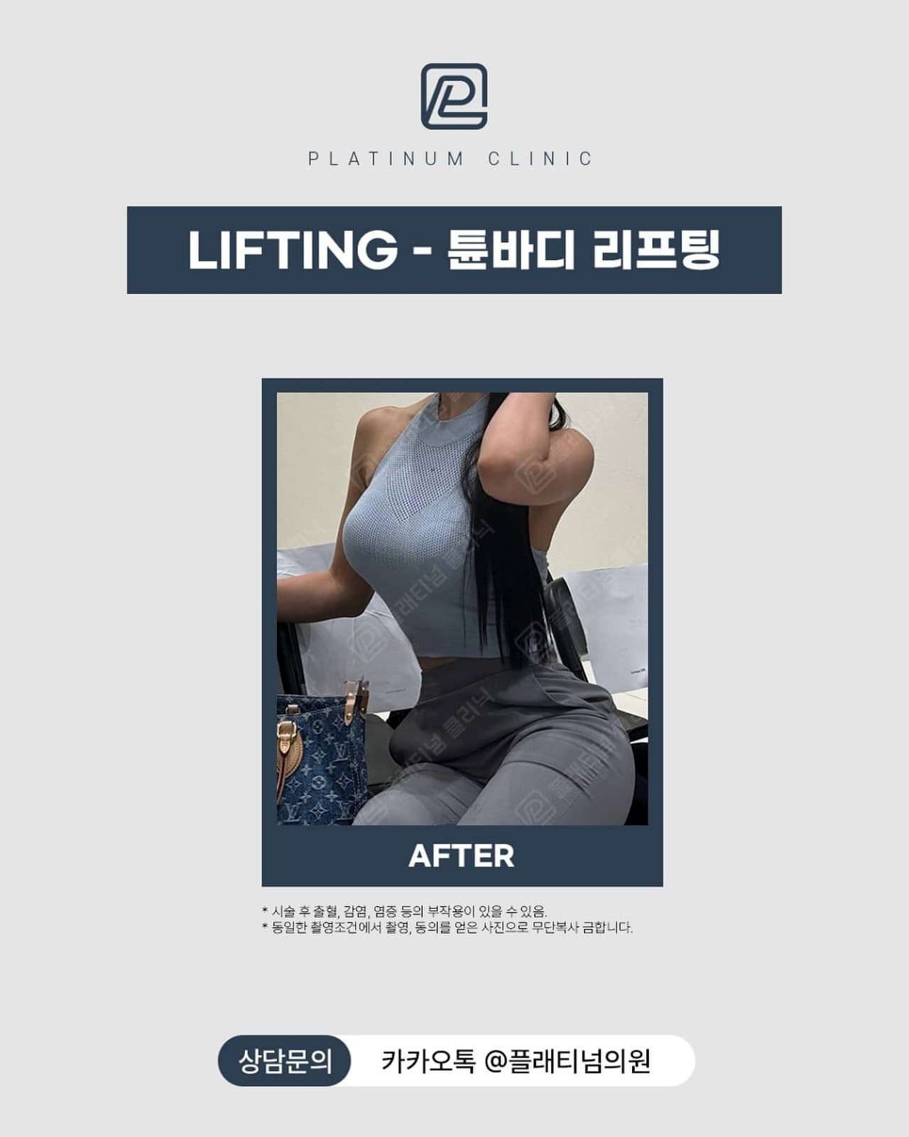 튠바디 체형 관리 전후