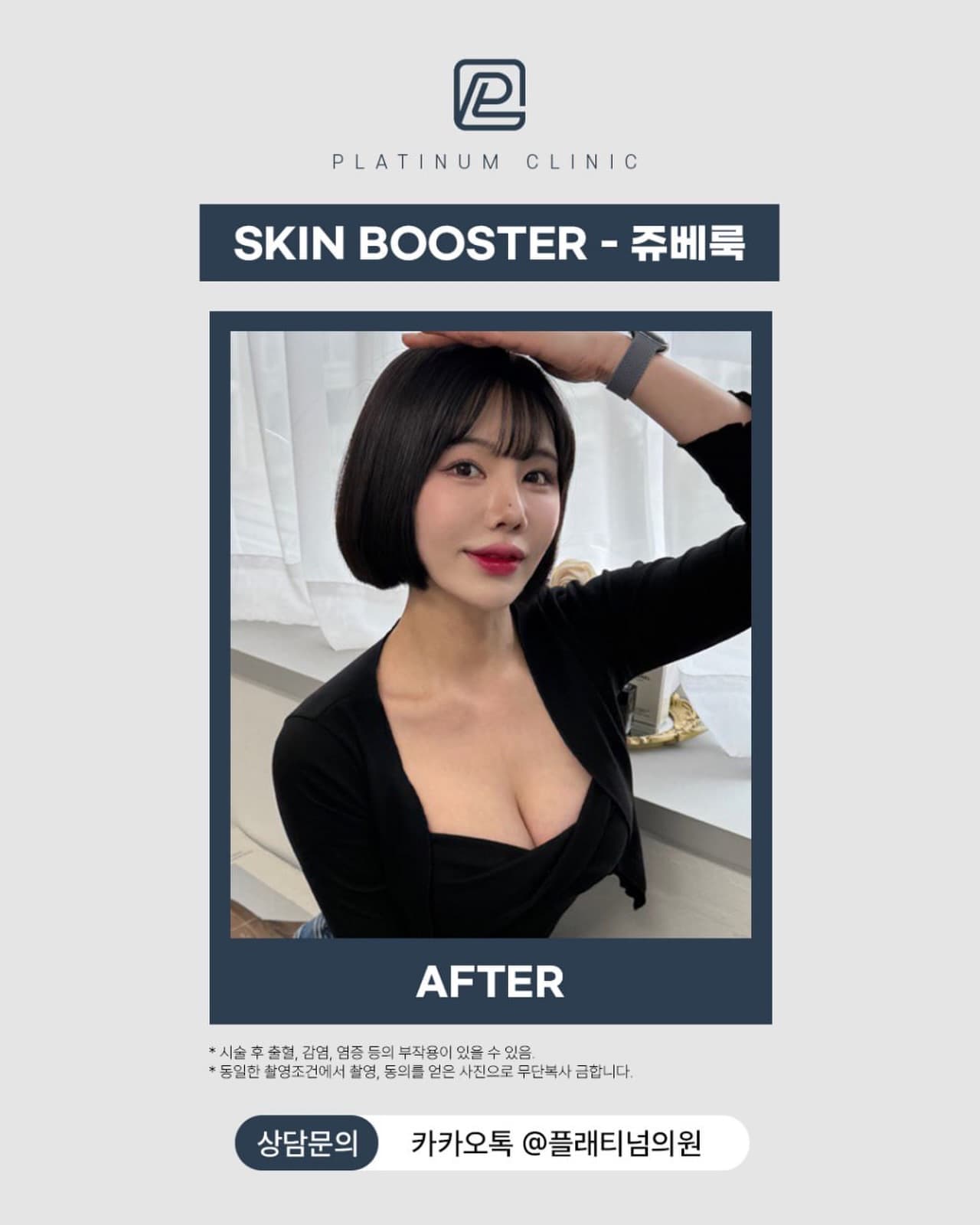 Juvelook Skin Before & After