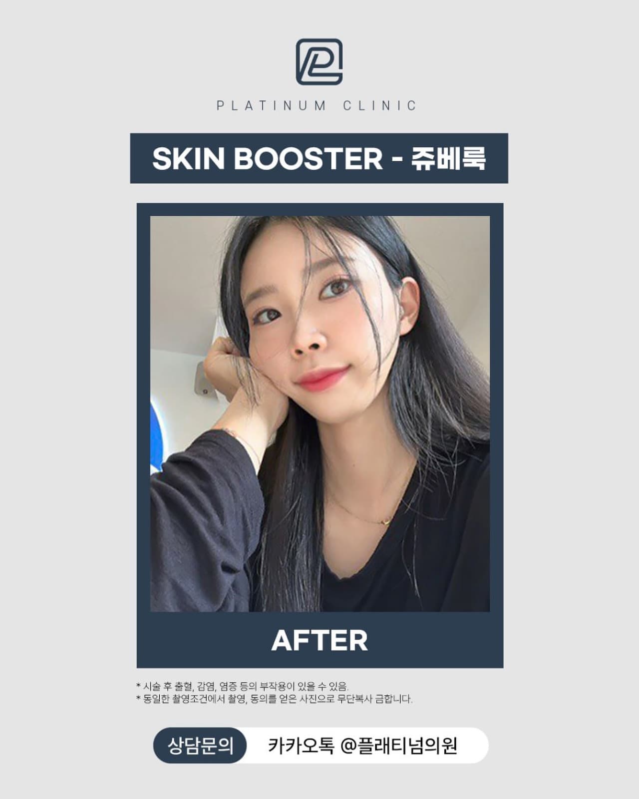 Juvelook Skin Booster Results