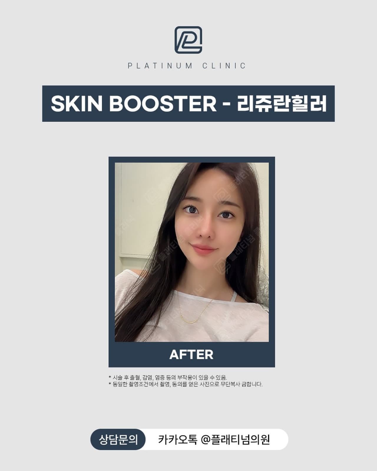 리쥬란 3회 프로그램 완료