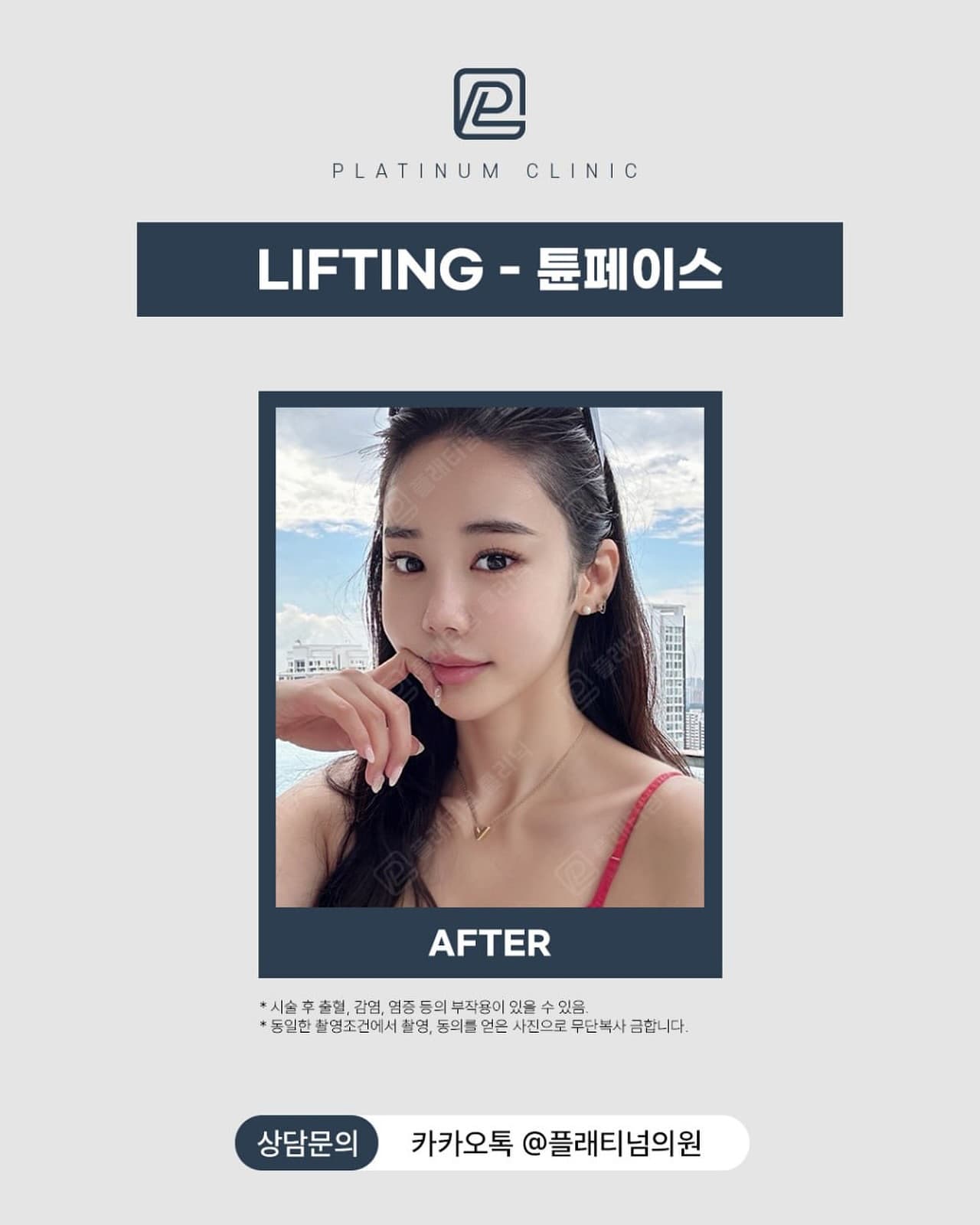 튠페이스 전후 비교