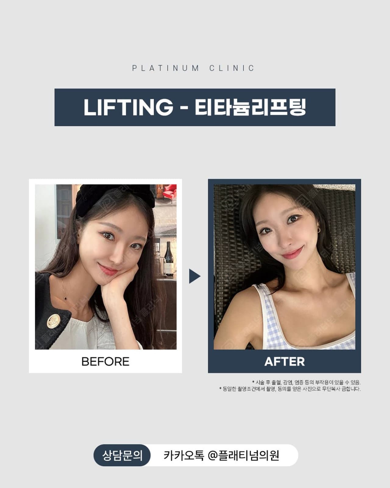 Titanium Lifting — 3rd Session Results